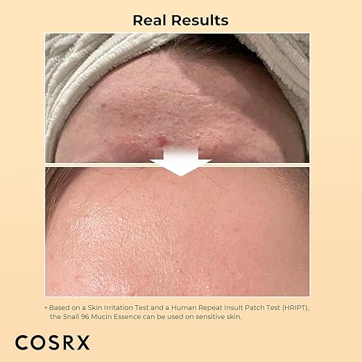 Cosrx Advanced Snail 96 Mucin Power Essence (100ml)