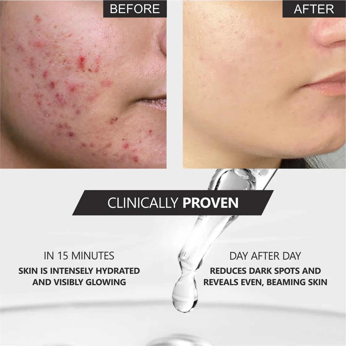 Lords Blemish Treatment Serum with AHA2 and BHA2