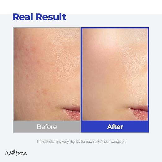 ISNTREE Hyaluronic Acid Aqua Gel Cream 3.38 fl.oz | Hydrating Gel Texture | Quick Absorbing Face Moisturizer | Refreshing Daily Skincare for Soft and Smooth Skin - 100ml